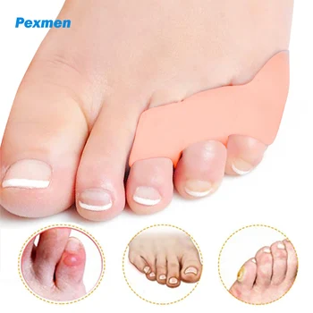 Pexmen 2 Adet Pinky Toe Ayırıcı ve Koruyucular Küçük Ayak Paspayı Örtüşen ve Çekiç Ayak Terzi Bunion Ağrı kesici